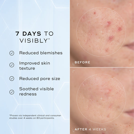 Niacinamide for Skin: Barrier, Brightness, and the Research