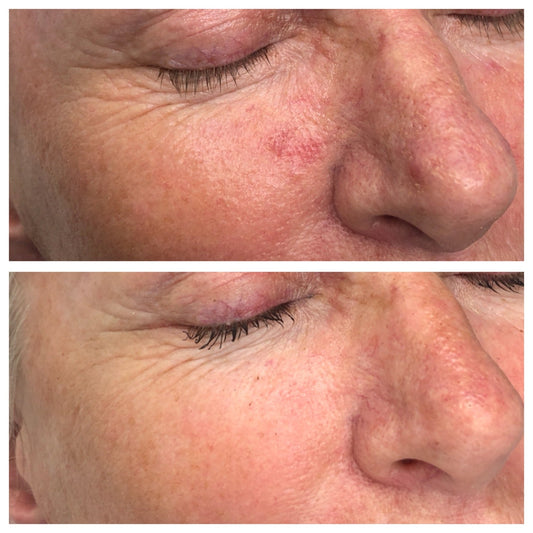 Which Adashiko Collagen Is Right for You?