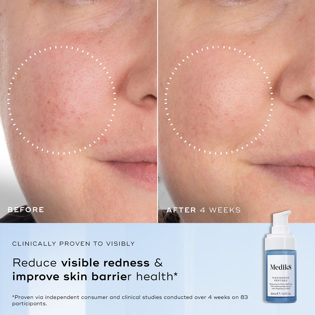 Medik8 Niacinamide Peptides NEW