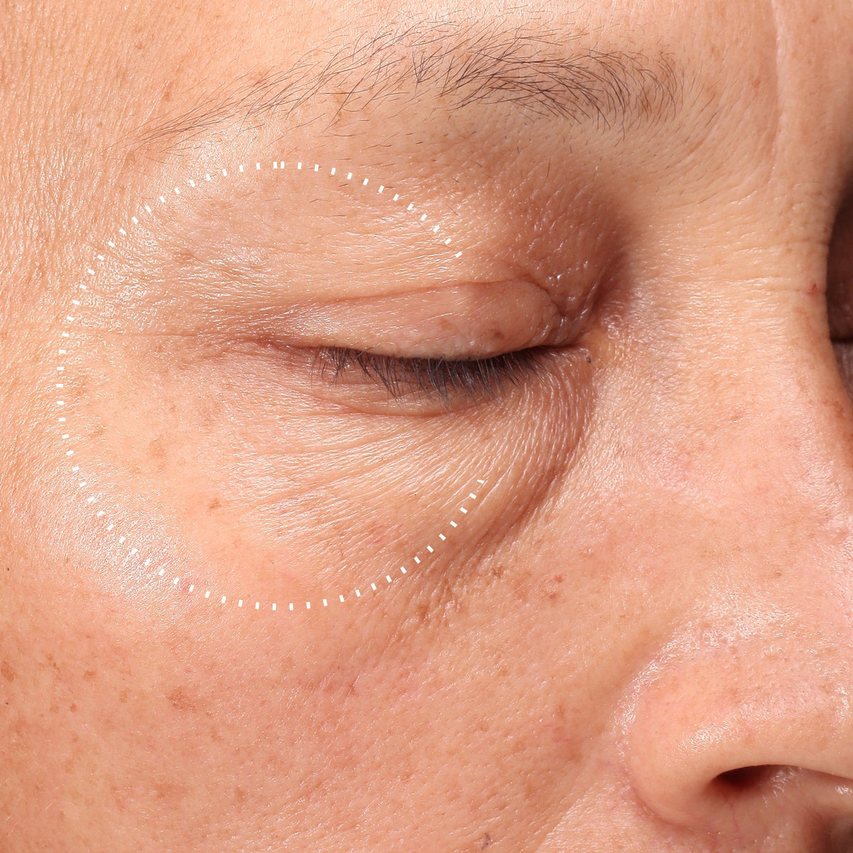 Medik8 Crystal Retinal Ceramide Eye 10