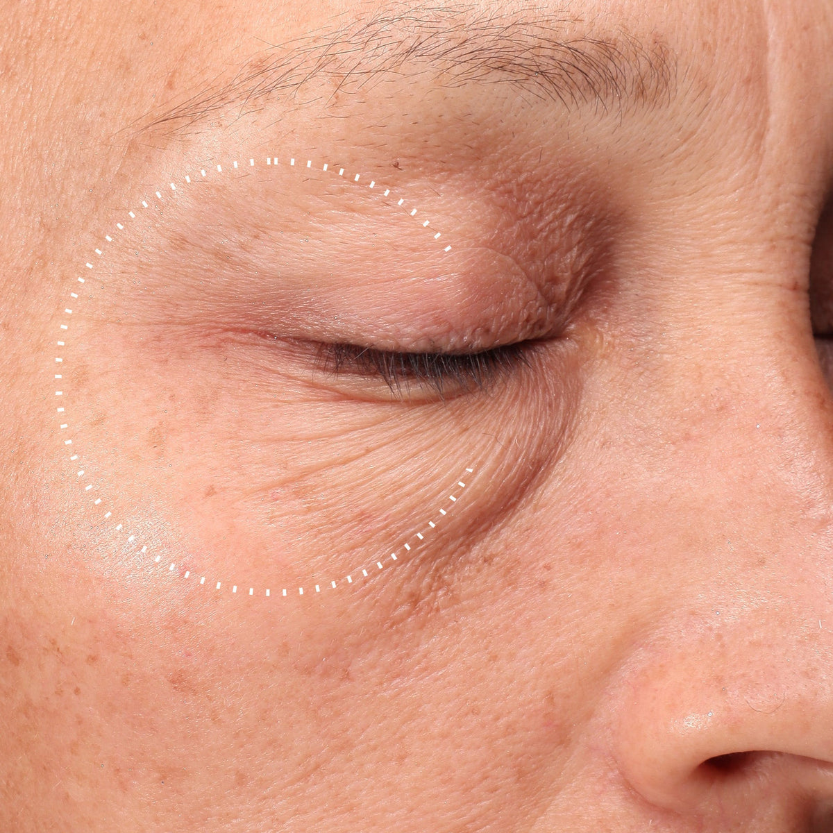 Medik8 Crystal Retinal Ceramide Eye 10